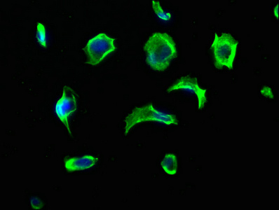 VASN Rabbit Polyclonal Antibody