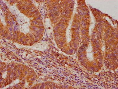 VASN Rabbit Polyclonal Antibody