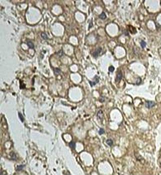 VCL Rabbit Polyclonal Antibody