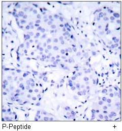 VEGFR2 (Phospho-Tyr1214) Antibody