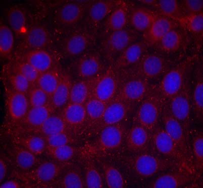 VEGFR2 (Phospho-Tyr1214) Antibody