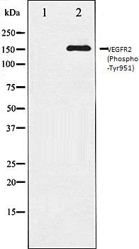 Phospho-VEGFR2 (Tyr951) Antibody