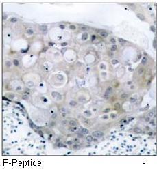 VEGFR2 (Phospho-Tyr951) Antibody