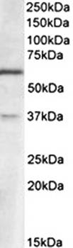 VGLUT2 (aa521-534) Antibody