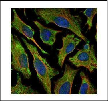 villin 1 Antibody