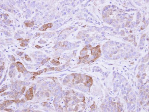 villin 1 Antibody