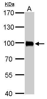 villin 1 Antibody