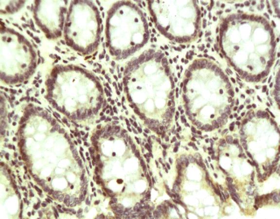 VIP Rabbit Polyclonal Antibody