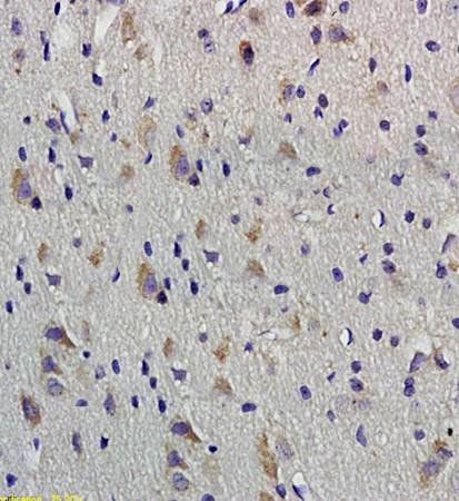 VIP Rabbit Polyclonal Antibody
