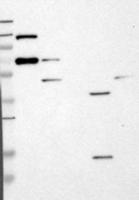 RSAD2 Antibody