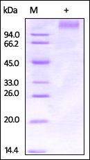 Ebolavirus EBOV Envelope Glycoprotein 1 Protein, His Tag
