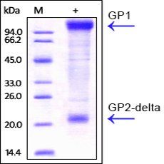 Ebolavirus EBOV Envelope Glycoprotein Protein, His Tag