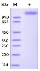 Influenza A Hemagglutinin (HA) Protein, Fc Tag