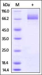 Influenza A Hemagglutinin (HA) Protein, His Tag