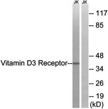 Vitamin D3 Receptor (Ab-51) Antibody