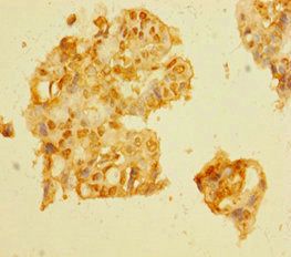 DCAF1 Antibody