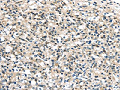 VPS26A Antibody