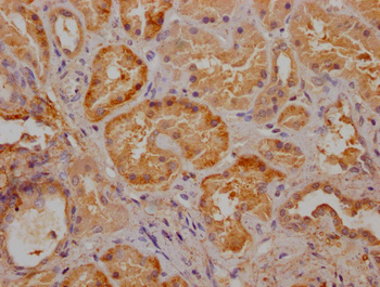 VPS26A Antibody