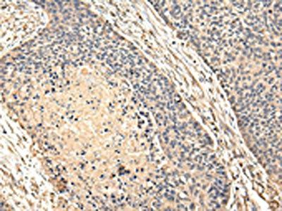 VPS28 Antibody