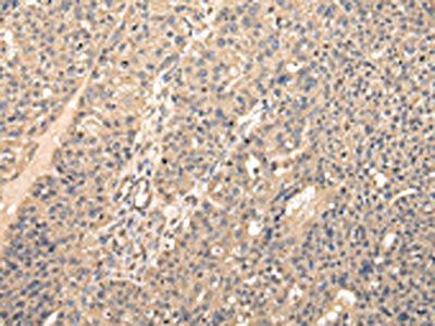 VPS28 Antibody