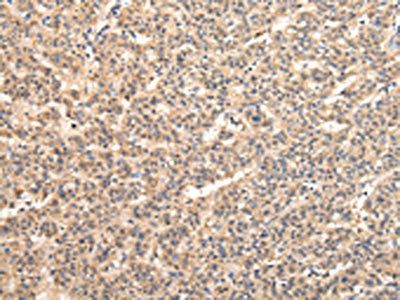 VPS33B Antibody