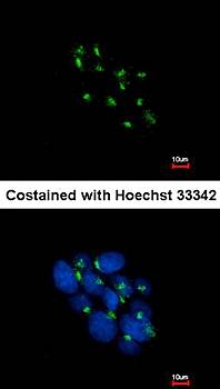 VPS35 Rabbit Polyclonal Antibody