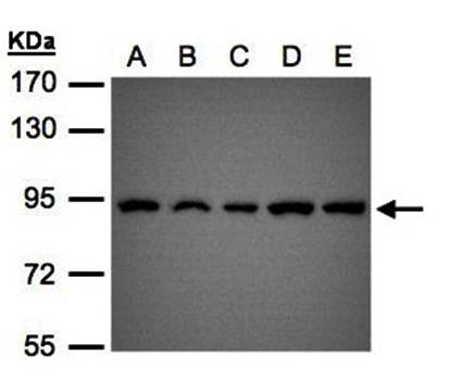 VPS35 Rabbit Polyclonal Antibody