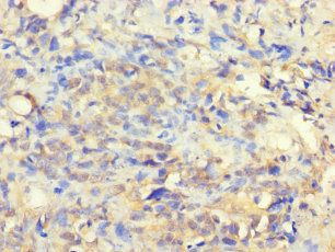 VTA1 Antibody