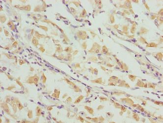INTS14 Antibody