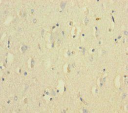 VWF Antibody