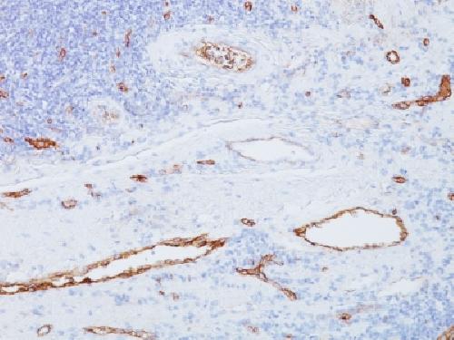 VWF Antibody