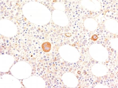VWF Antibody