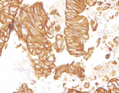 CD274 Antibody