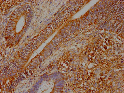 WARS Antibody