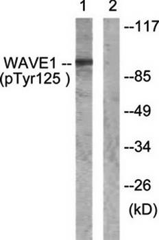 WAVE1 (Phospho-Tyr125) Antibody