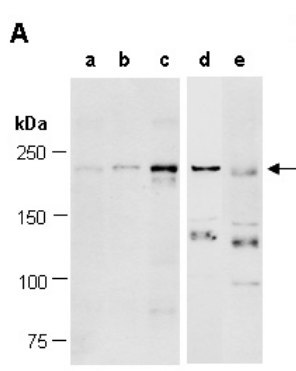 TET1 (C2) Antibody, Rabbit Polyclonal