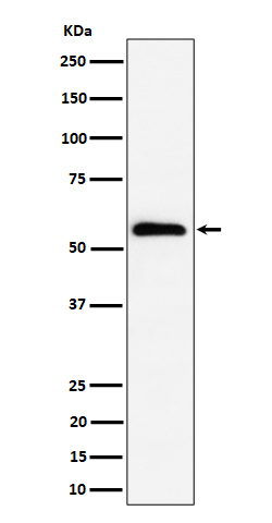 PNK/PNKP Rabbit Monoclonal Antibody