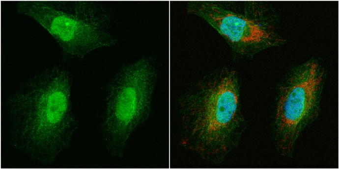 WBSCR22 antibody