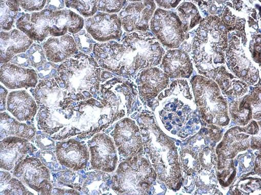 WBSCR22 antibody