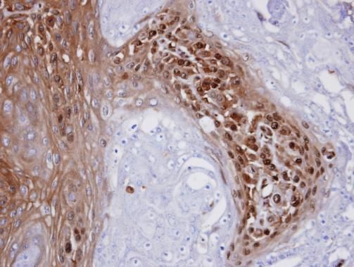 WBSCR22 antibody