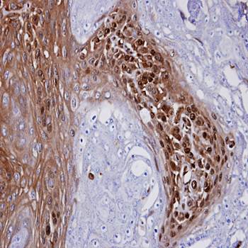 WBSCR22 antibody