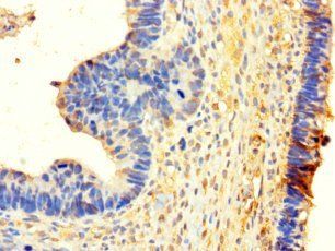 NSD3 Antibody