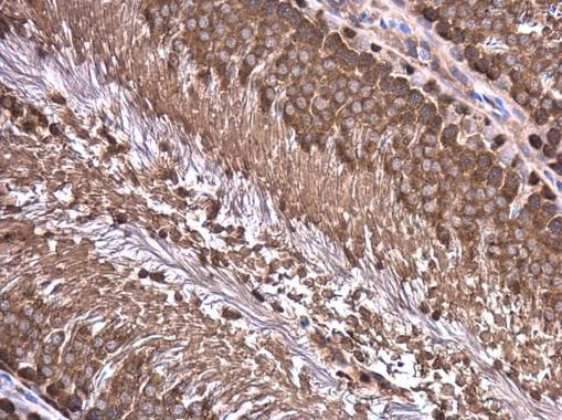 Wilms Tumor 1 Rabbit Polyclonal Antibody