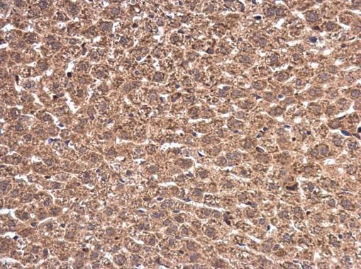 Wilms Tumor 1 Rabbit Polyclonal Antibody