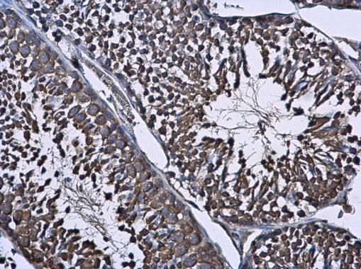 Wilms Tumor 1 Rabbit Polyclonal Antibody