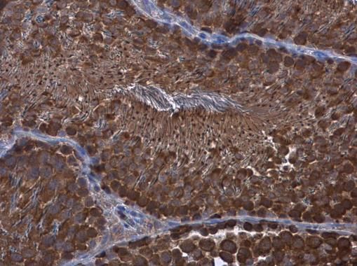 Wilms Tumor 1 Rabbit Polyclonal Antibody