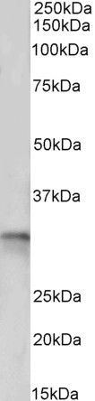 tropomyosin 4/TPM4 Antibody