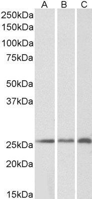 CRP2/CSRP2 Antibody