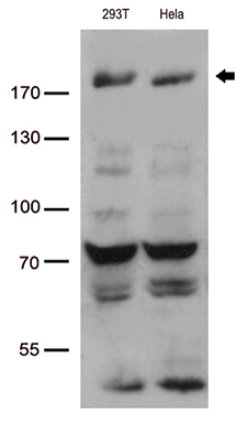 BAZ1B Antibody