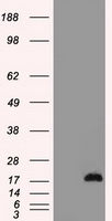 BAZ1B Antibody